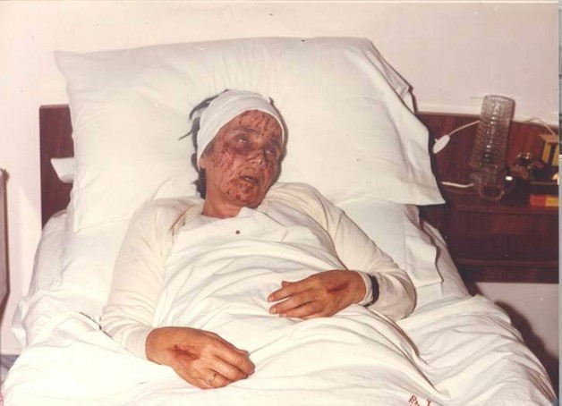 Cuộc sống yêu thương của sơ Dolores Barone, người được in dấu thánh trên đôi bàn tay