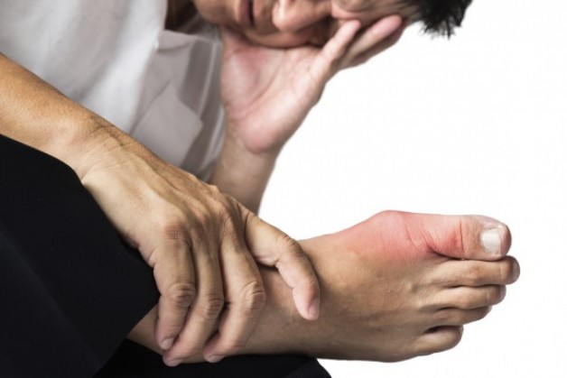 Người bị bệnh gút: Nên và không nên ăn gì?
