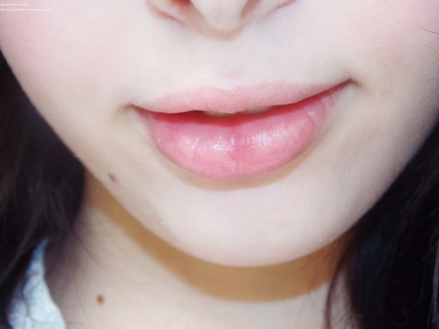 10 dấu hiệu bệnh tật chớ bỏ qua