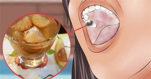 Bài thuốc quá dễ trị răng lung lay ê buốt, tới già răng vẫn không rụng