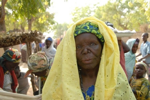 LỜI CẦU CỦA 1 NGƯỜI CÙI